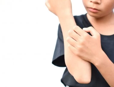 Δερματίτιδα εξ επαφής: Συμπτώματα, αιτίες, αντιμετώπιση (βίντεο)